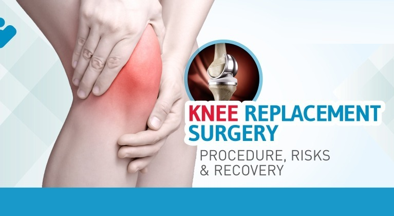 The implication of joint replacement surgery for the joint treatment