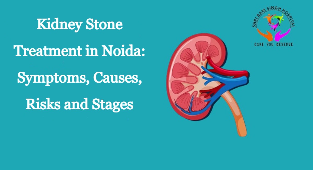 Kidney Stone Treatment in Noida: Symptoms, Causes, Risks and Stages