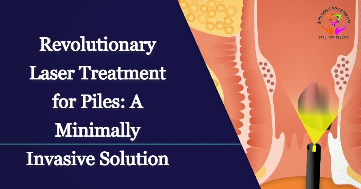 Revolutionary Laser Treatment for Piles: A Minimally Invasive Solution