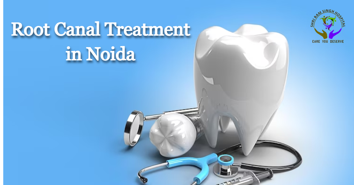 Root Canal Treatment in Noida