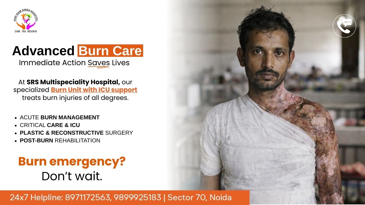 Burn Injuries Are Medical Emergencies: Why Immediate Burn Care Can Save Lives