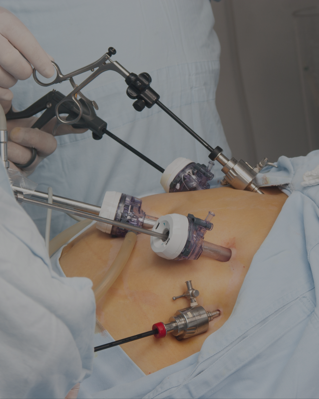 General & Laparoscopic Surgery