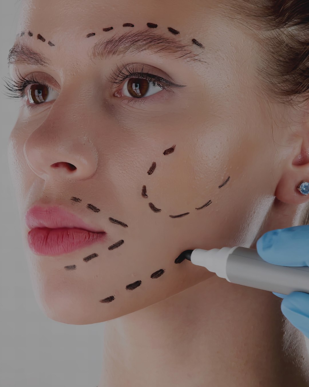 Burn & Plastic Surgery