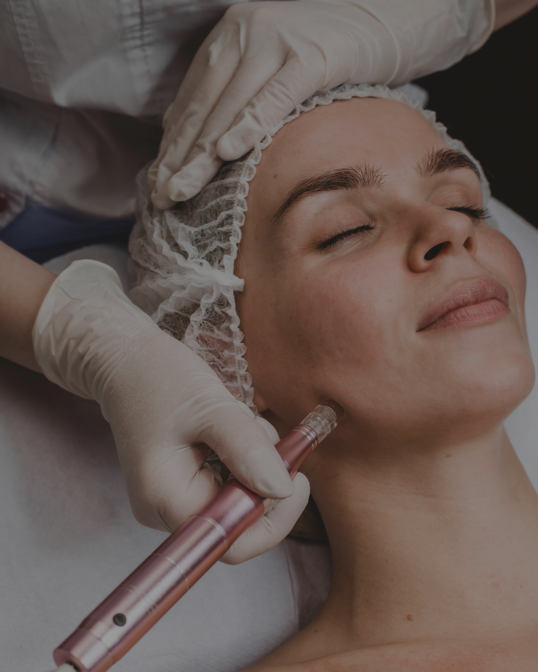 Dermatology